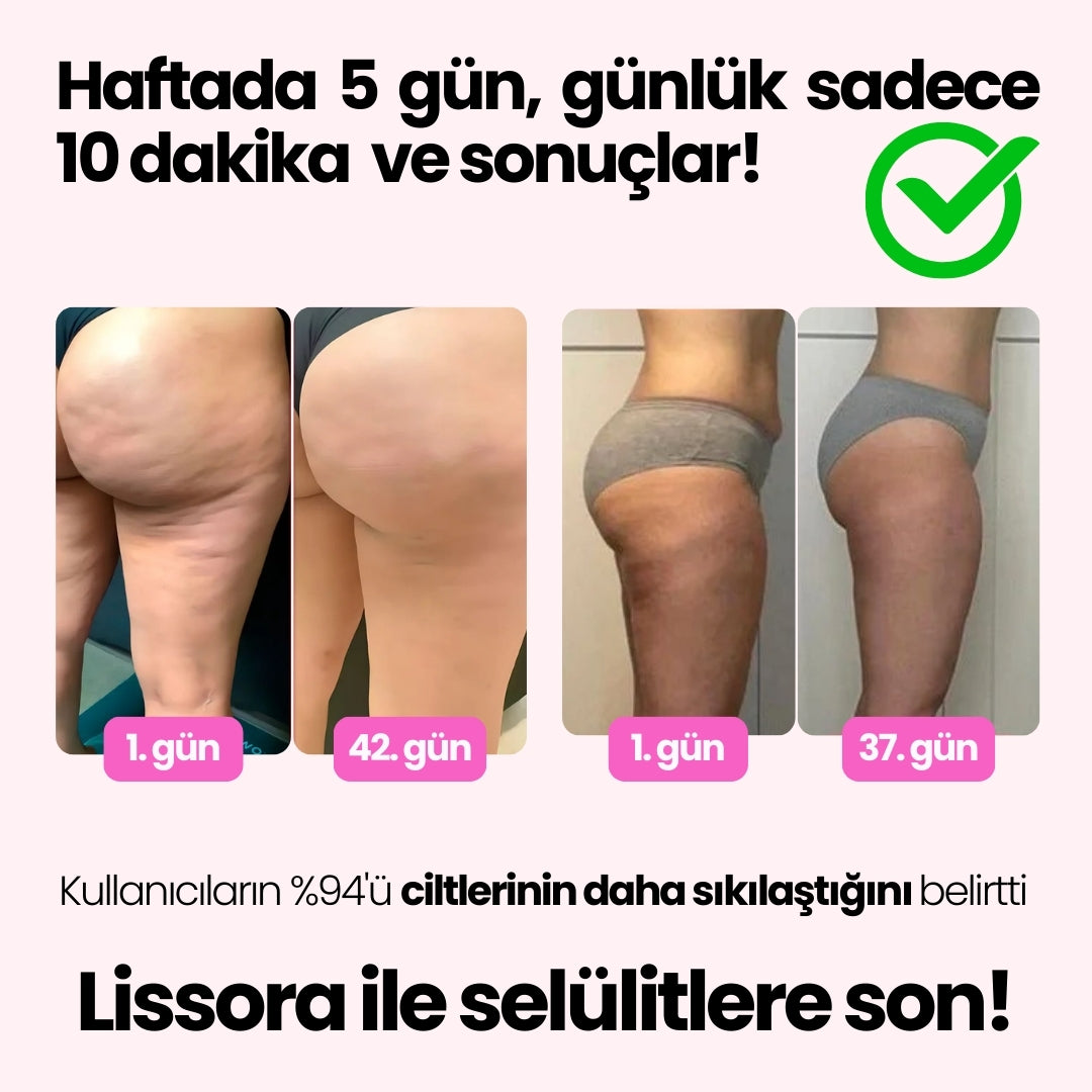 The Lissora™ Selülit Giderici Masaj Aleti