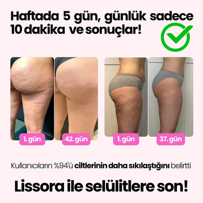 The Lissora™ Selülit Giderici Masaj Aleti